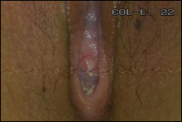 Wound Review